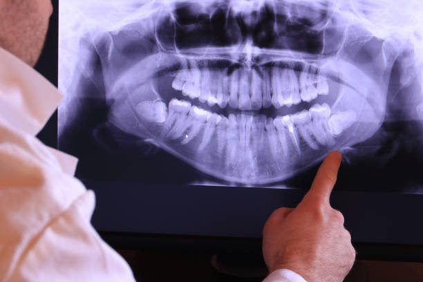 Best Emergency Care for Gum Disease in Beckett Ridge, OH