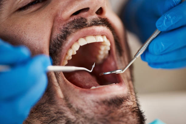 Best Emergency Cosmetic Dentistry (e.g., broken veneers) in Beckett Ridge, OH