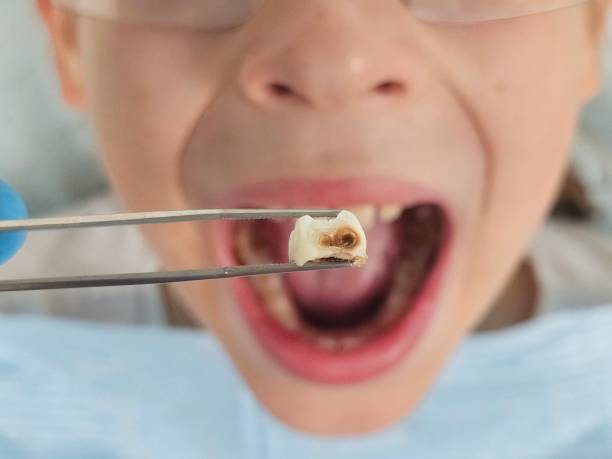 Best Emergency Denture Repair in Beckett Ridge, OH